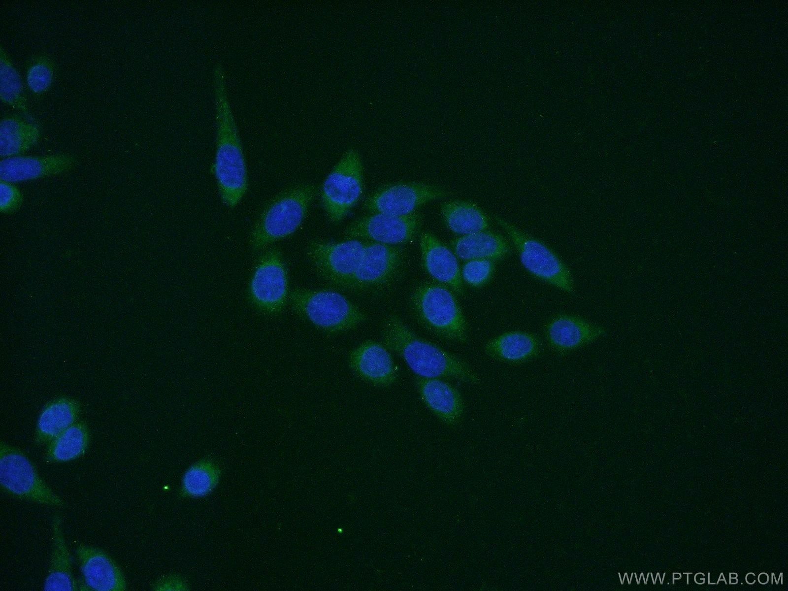 Immunofluorescence (IF) / fluorescent staining of HeLa cells using MAPKAPK5 Polyclonal antibody (14339-1-AP)