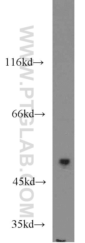 Western Blot (WB) analysis of HeLa cells using MAPKAPK5 Polyclonal antibody (14339-1-AP)
