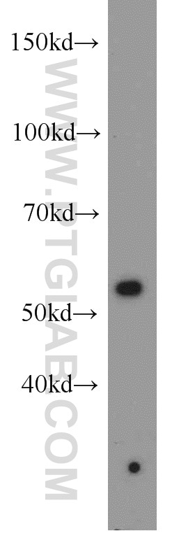 Western Blot (WB) analysis of Jurkat cells using MAPKAPK5 Polyclonal antibody (14339-1-AP)