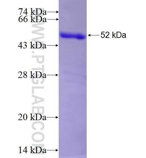 MAPKAPK5 fusion protein Ag5650 SDS-PAGE