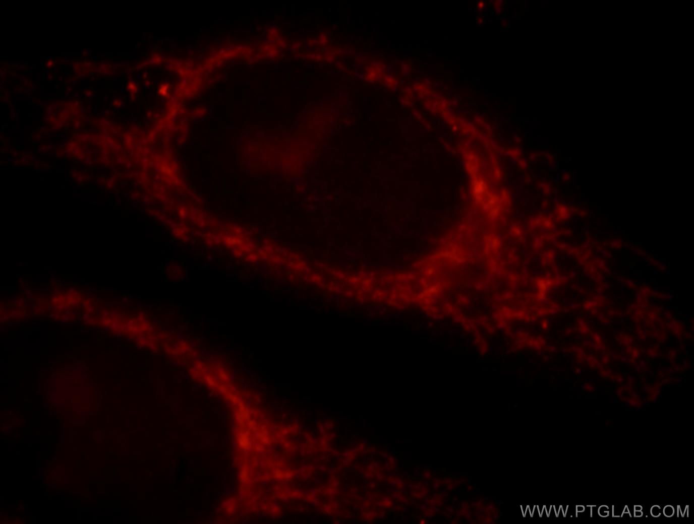 Immunofluorescence (IF) / fluorescent staining of HepG2 cells using MAPKBP1 Polyclonal antibody (17788-1-AP)