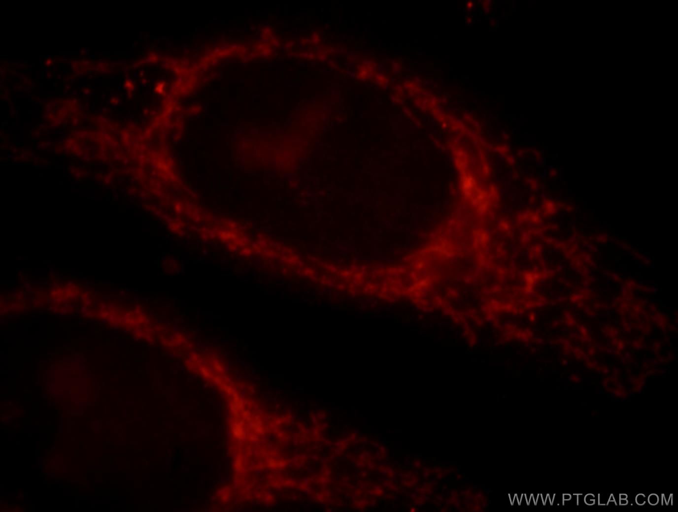 IF Staining of HepG2 using 17788-1-AP