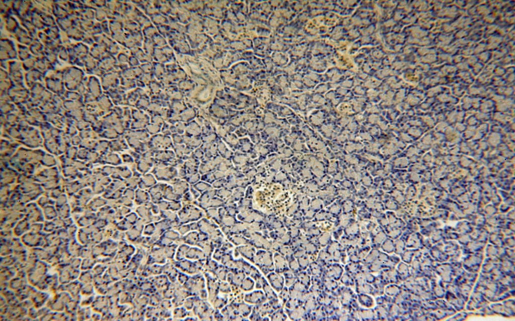 Immunohistochemistry (IHC) staining of human pancreas tissue using MAPKBP1 Polyclonal antibody (17788-1-AP)