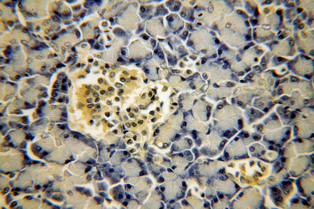 Immunohistochemistry (IHC) staining of human pancreas tissue using MAPKBP1 Polyclonal antibody (17788-1-AP)