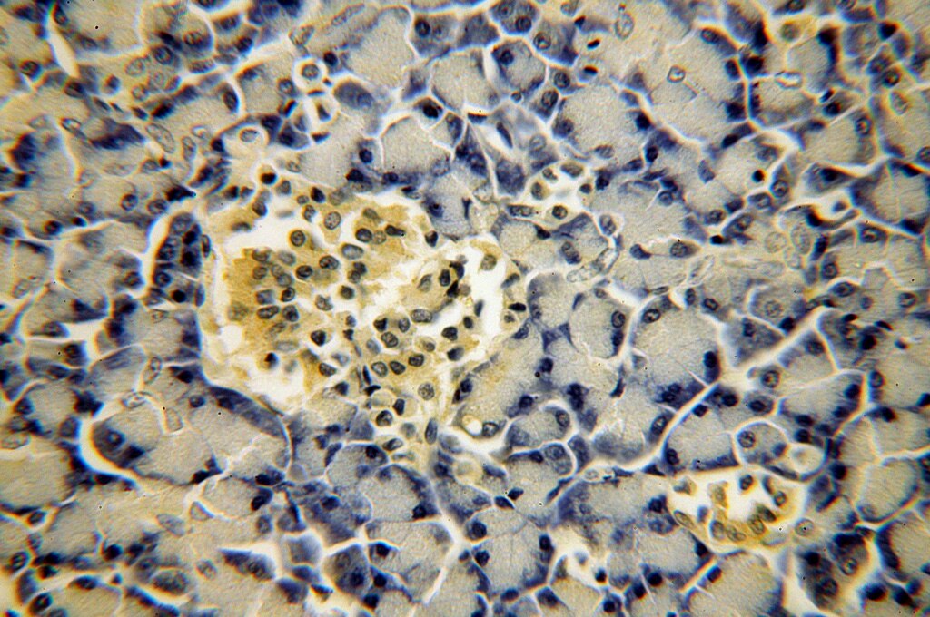 IHC staining of human pancreas using 17788-1-AP