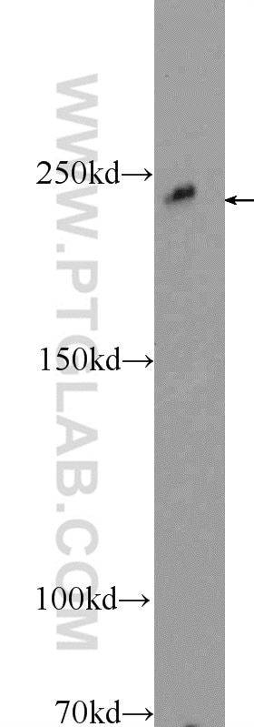 Western Blot (WB) analysis of rat liver tissue using MAPKBP1 Polyclonal antibody (17788-1-AP)