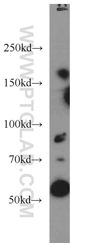 MAPKBP1