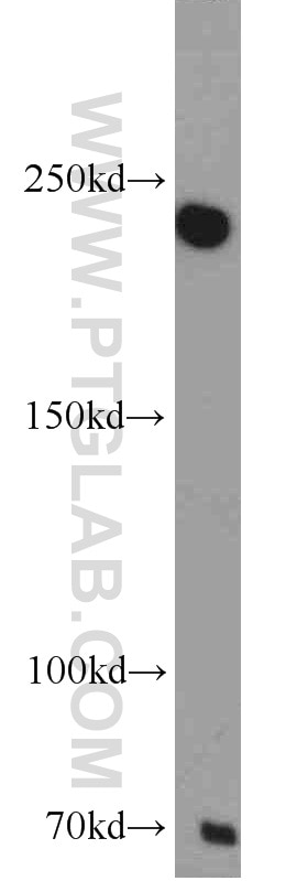 Western Blot (WB) analysis of mouse liver tissue using MAPKBP1 Polyclonal antibody (17788-1-AP)