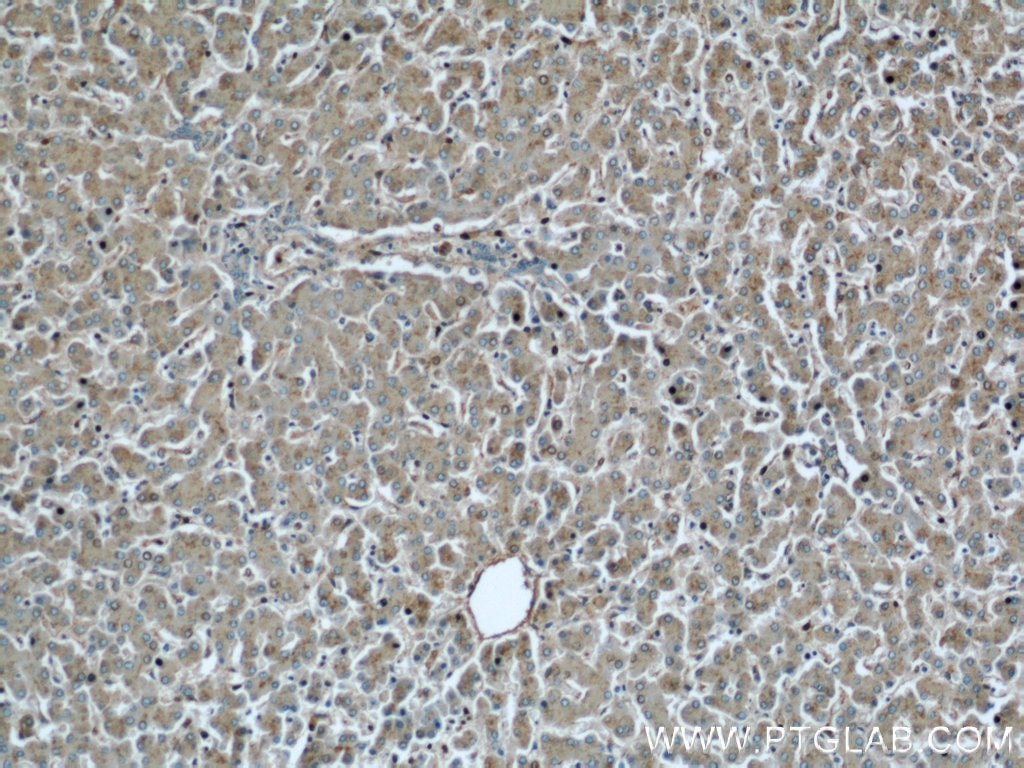Immunohistochemistry (IHC) staining of human liver tissue using MAPKSP1 Polyclonal antibody (11937-1-AP)