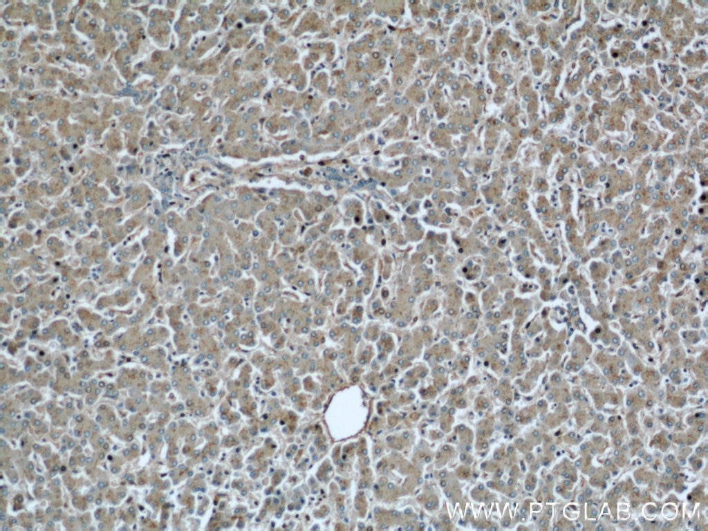 Immunohistochemistry (IHC) staining of human liver tissue using MAPKSP1 Polyclonal antibody (11937-1-AP)