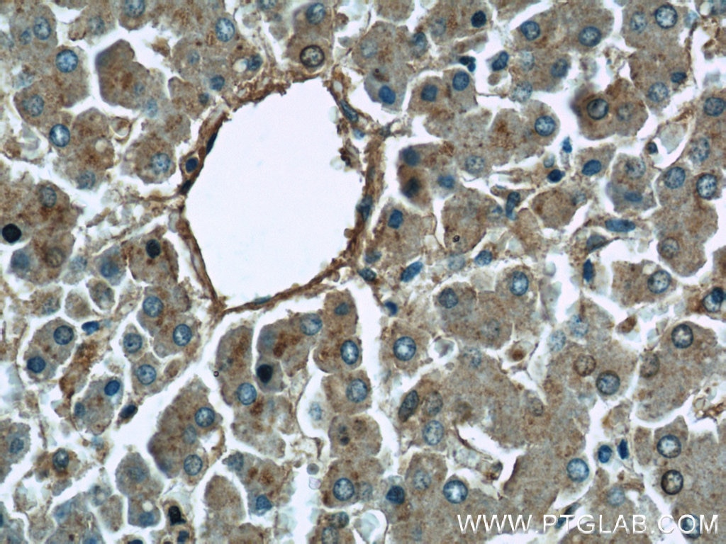Immunohistochemistry (IHC) staining of human liver tissue using MAPKSP1 Polyclonal antibody (11937-1-AP)