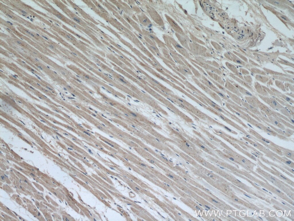 Immunohistochemistry (IHC) staining of human heart tissue using MAPKSP1 Polyclonal antibody (11937-1-AP)