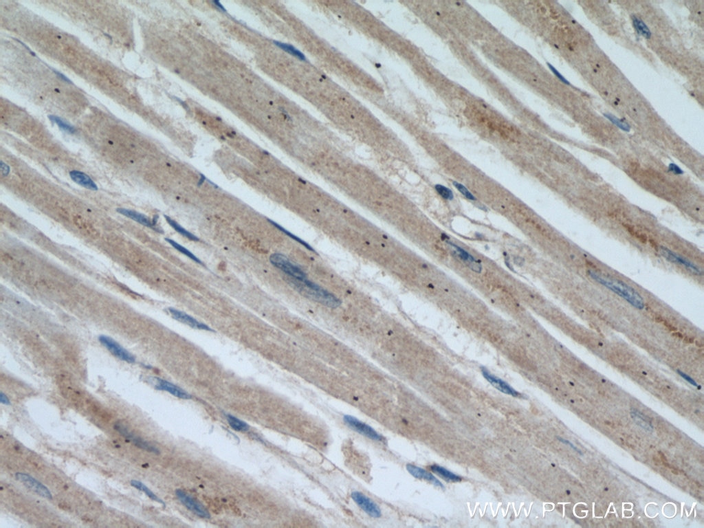 Immunohistochemistry (IHC) staining of human heart tissue using MAPKSP1 Polyclonal antibody (11937-1-AP)