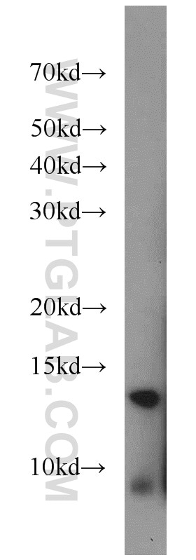 Western Blot (WB) analysis of mouse liver tissue using MAPKSP1 Polyclonal antibody (11937-1-AP)