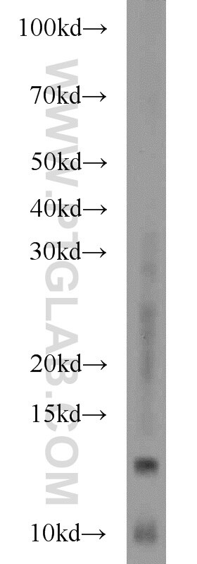 Western Blot (WB) analysis of mouse brain tissue using MAPKSP1 Polyclonal antibody (11937-1-AP)