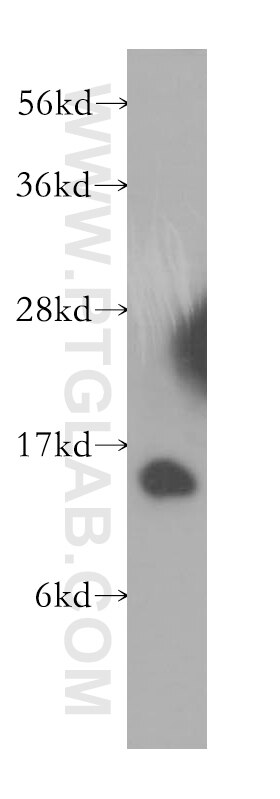 Western Blot (WB) analysis of human liver tissue using MAPKSP1 Polyclonal antibody (11937-1-AP)