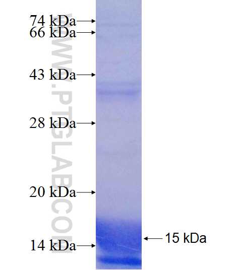 MAPKSP1 fusion protein Ag18319 SDS-PAGE