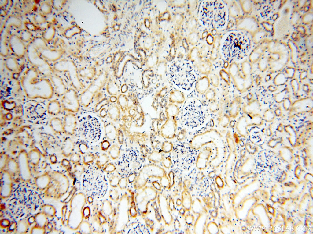 Immunohistochemistry (IHC) staining of human kidney tissue using EB1 Polyclonal antibody (17717-1-AP)