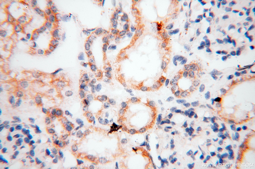 Immunohistochemistry (IHC) staining of human kidney tissue using EB1 Polyclonal antibody (17717-1-AP)
