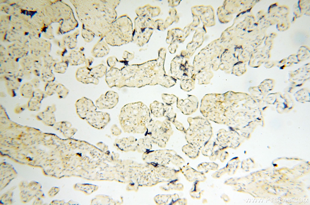Immunohistochemistry (IHC) staining of human placenta tissue using EB1 Polyclonal antibody (17717-1-AP)