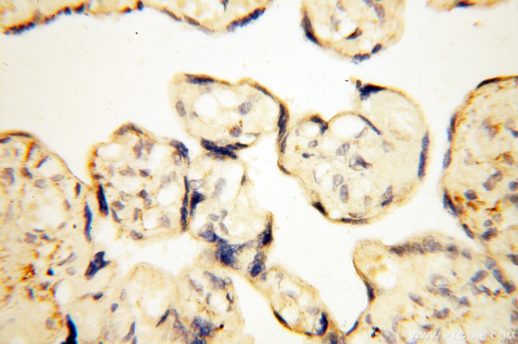 Immunohistochemistry (IHC) staining of human placenta tissue using EB1 Polyclonal antibody (17717-1-AP)