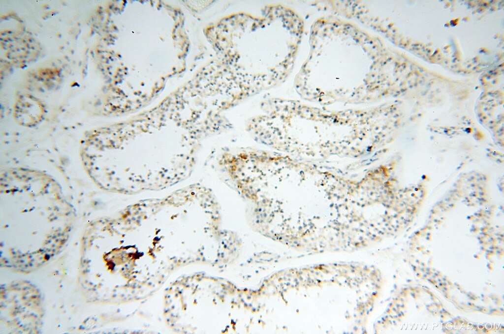 IHC staining of human testis using 17717-1-AP