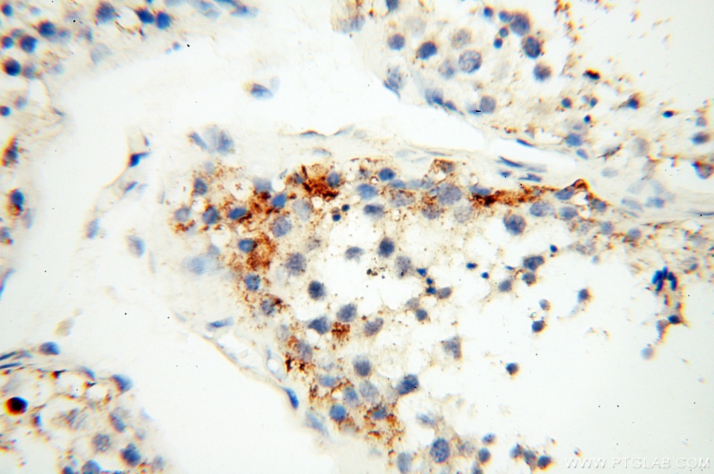 Immunohistochemistry (IHC) staining of human testis tissue using EB1 Polyclonal antibody (17717-1-AP)