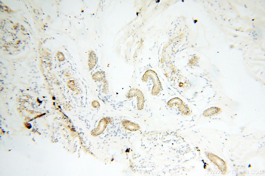 Immunohistochemistry (IHC) staining of human skin tissue using EB1 Polyclonal antibody (17717-1-AP)