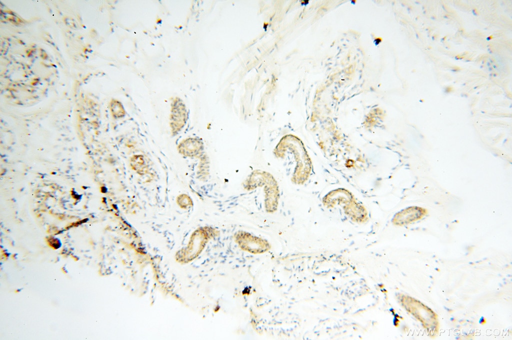 IHC staining of human skin using 17717-1-AP