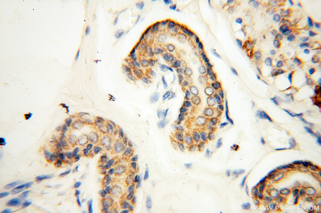 Immunohistochemistry (IHC) staining of human skin tissue using EB1 Polyclonal antibody (17717-1-AP)