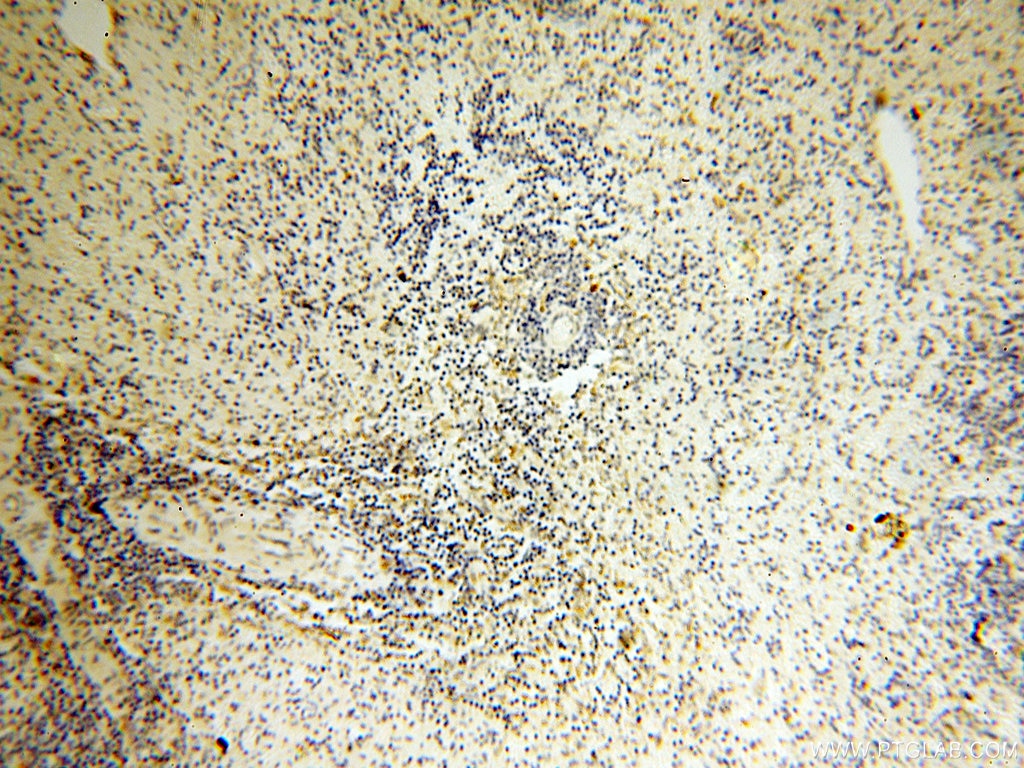 Immunohistochemistry (IHC) staining of human spleen tissue using EB1 Polyclonal antibody (17717-1-AP)