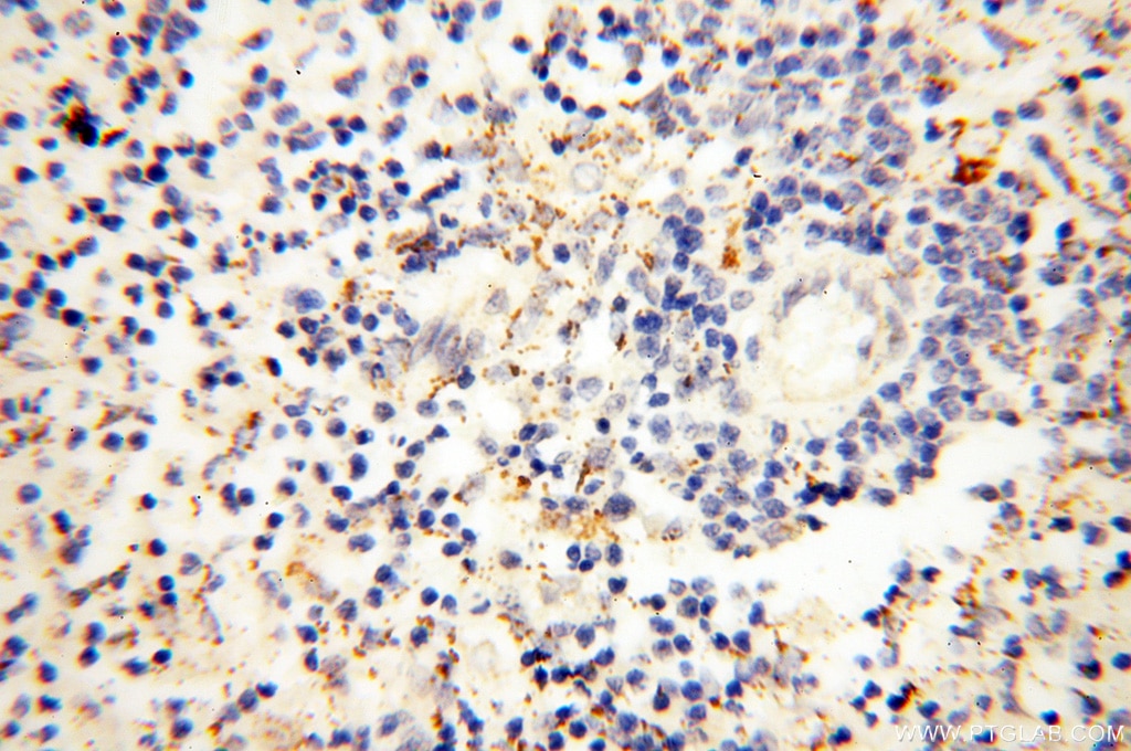 Immunohistochemistry (IHC) staining of human spleen tissue using EB1 Polyclonal antibody (17717-1-AP)