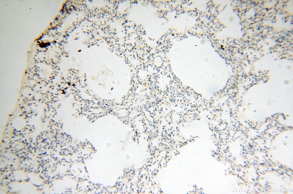 Immunohistochemistry (IHC) staining of human lung tissue using EB1 Polyclonal antibody (17717-1-AP)