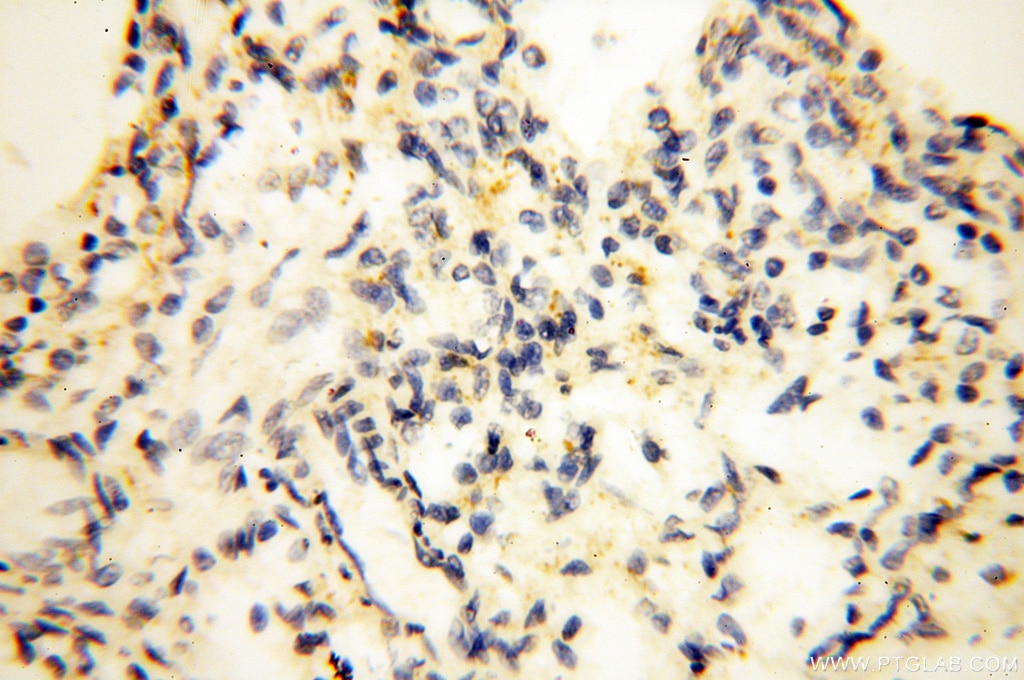 IHC staining of human lung using 17717-1-AP