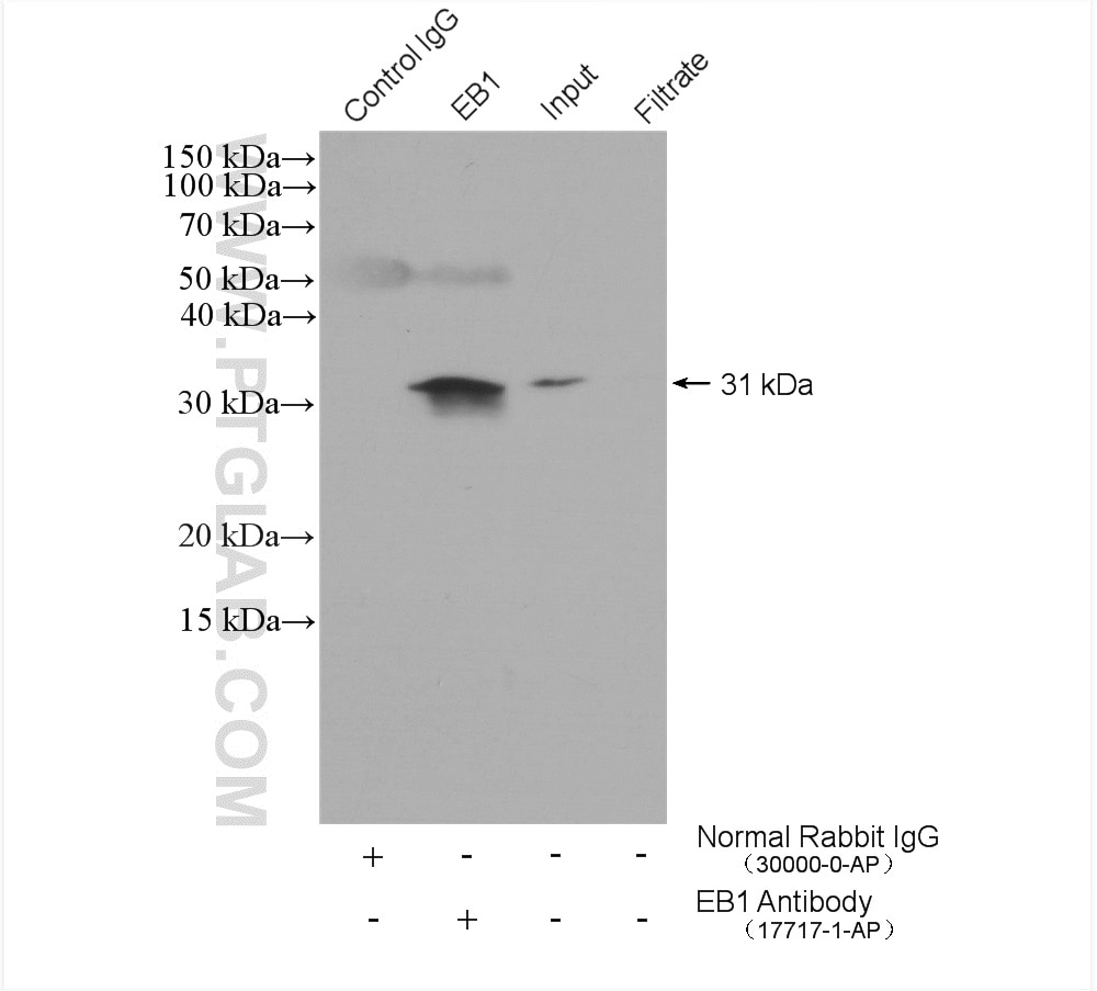 Immunoprecipitation (IP) experiment of Caco-2 cells using EB1 Polyclonal antibody (17717-1-AP)