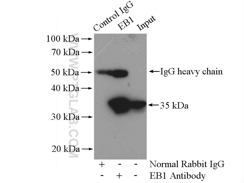 Immunoprecipitation (IP) experiment of HeLa cells using EB1 Polyclonal antibody (17717-1-AP)