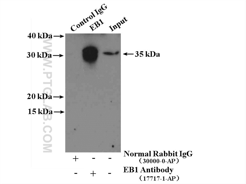 Immunoprecipitation (IP) experiment of mouse thymus tissue using EB1 Polyclonal antibody (17717-1-AP)