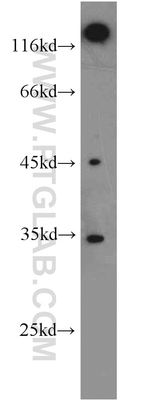 Western Blot (WB) analysis of Jurkat cells using EB1 Polyclonal antibody (17717-1-AP)