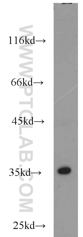 Western Blot (WB) analysis of A431 cells using EB1 Polyclonal antibody (17717-1-AP)
