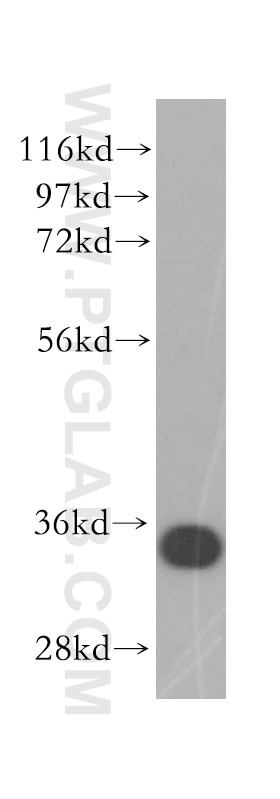 Western Blot (WB) analysis of HeLa cells using EB1 Polyclonal antibody (17717-1-AP)