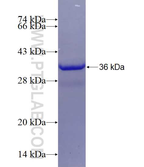EB1 fusion protein Ag12092 SDS-PAGE