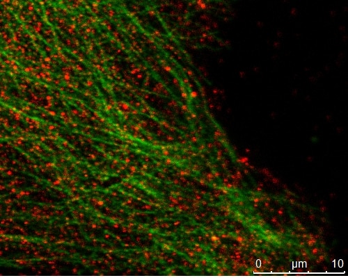 Immunofluorescence (IF) / fluorescent staining of mouse cells using MAPRE2 Polyclonal antibody (10364-1-AP)