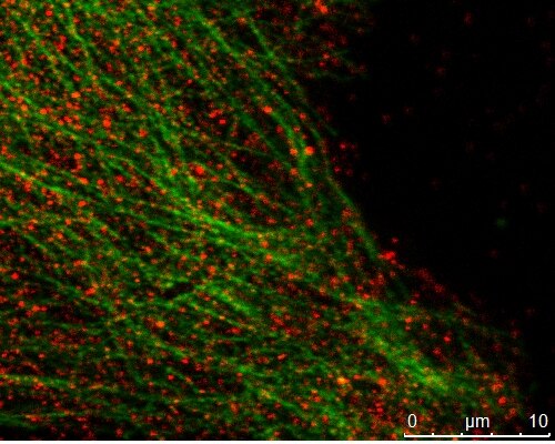 IF Staining of mouse cells using 10364-1-AP