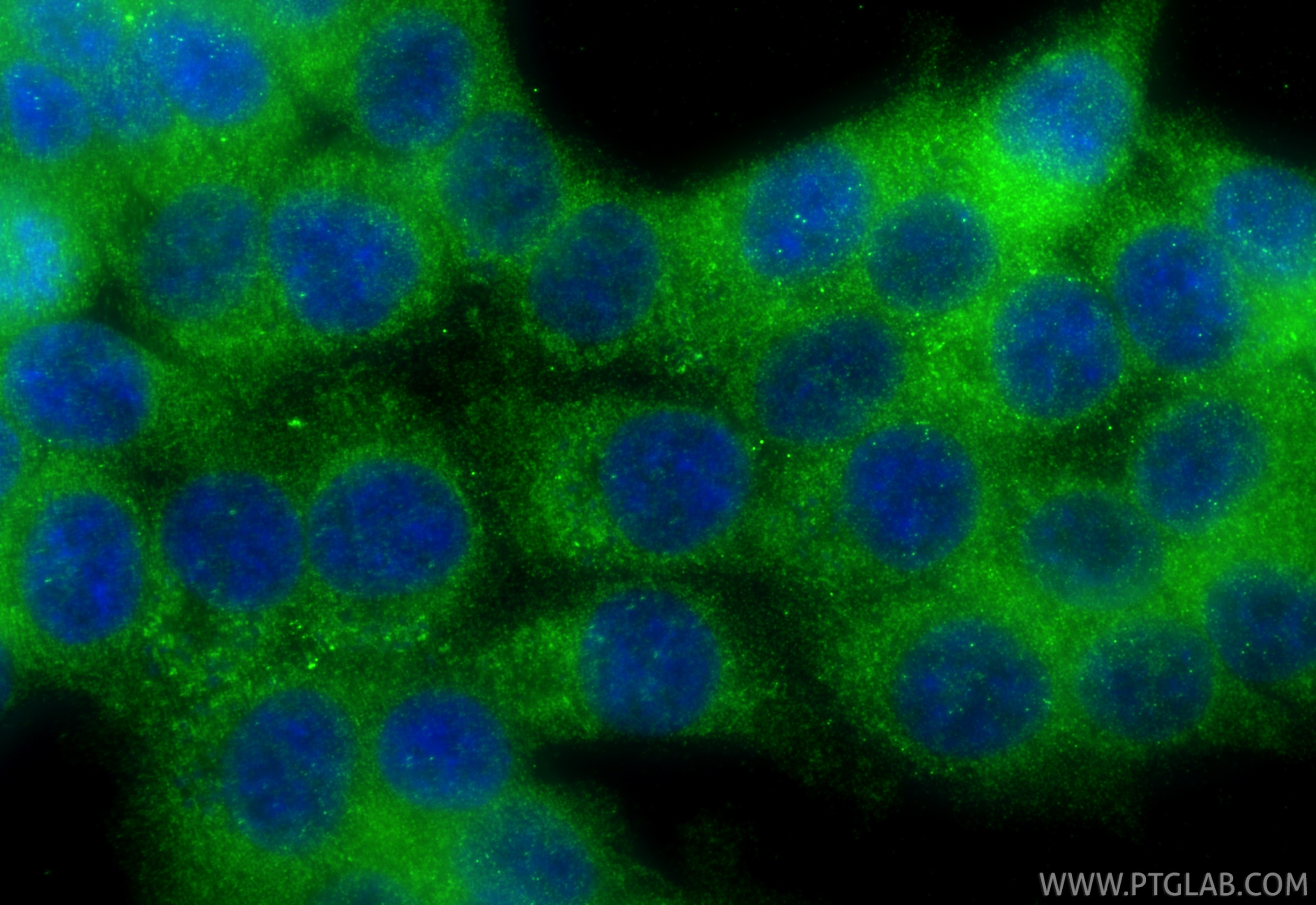 Immunofluorescence (IF) / fluorescent staining of HCT 116 cells using MAPRE2 Polyclonal antibody (10364-1-AP)