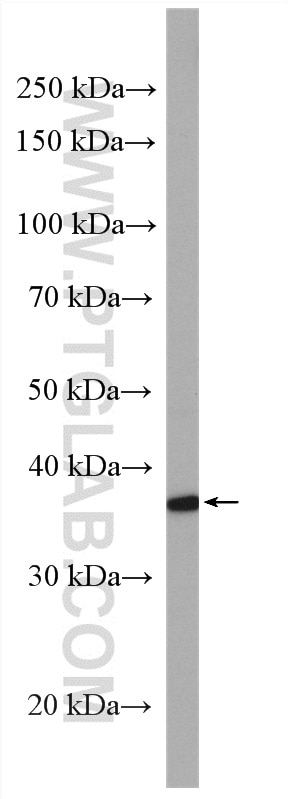 Western Blot (WB) analysis of Jurkat cells using MAPRE2 Polyclonal antibody (10364-1-AP)