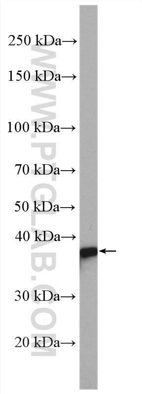 Western Blot (WB) analysis of K-562 cells using MAPRE2 Polyclonal antibody (10364-1-AP)