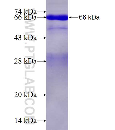 MAPRE2 fusion protein Ag0416 SDS-PAGE