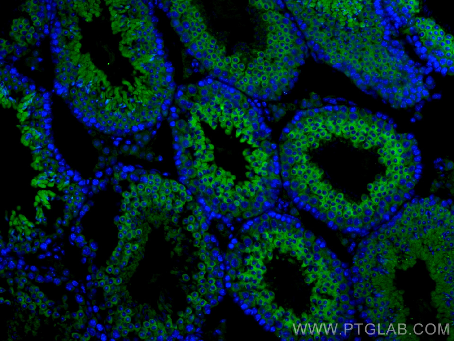 Immunofluorescence (IF) / fluorescent staining of mouse testis tissue using EB3 Polyclonal antibody (23974-1-AP)