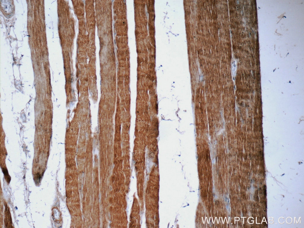 Immunohistochemistry (IHC) staining of human skeletal muscle tissue using EB3 Polyclonal antibody (23974-1-AP)