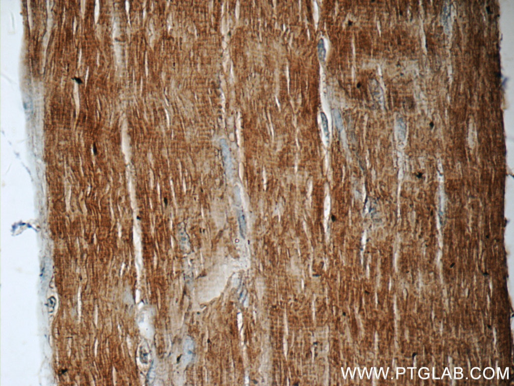 Immunohistochemistry (IHC) staining of human skeletal muscle tissue using EB3 Polyclonal antibody (23974-1-AP)